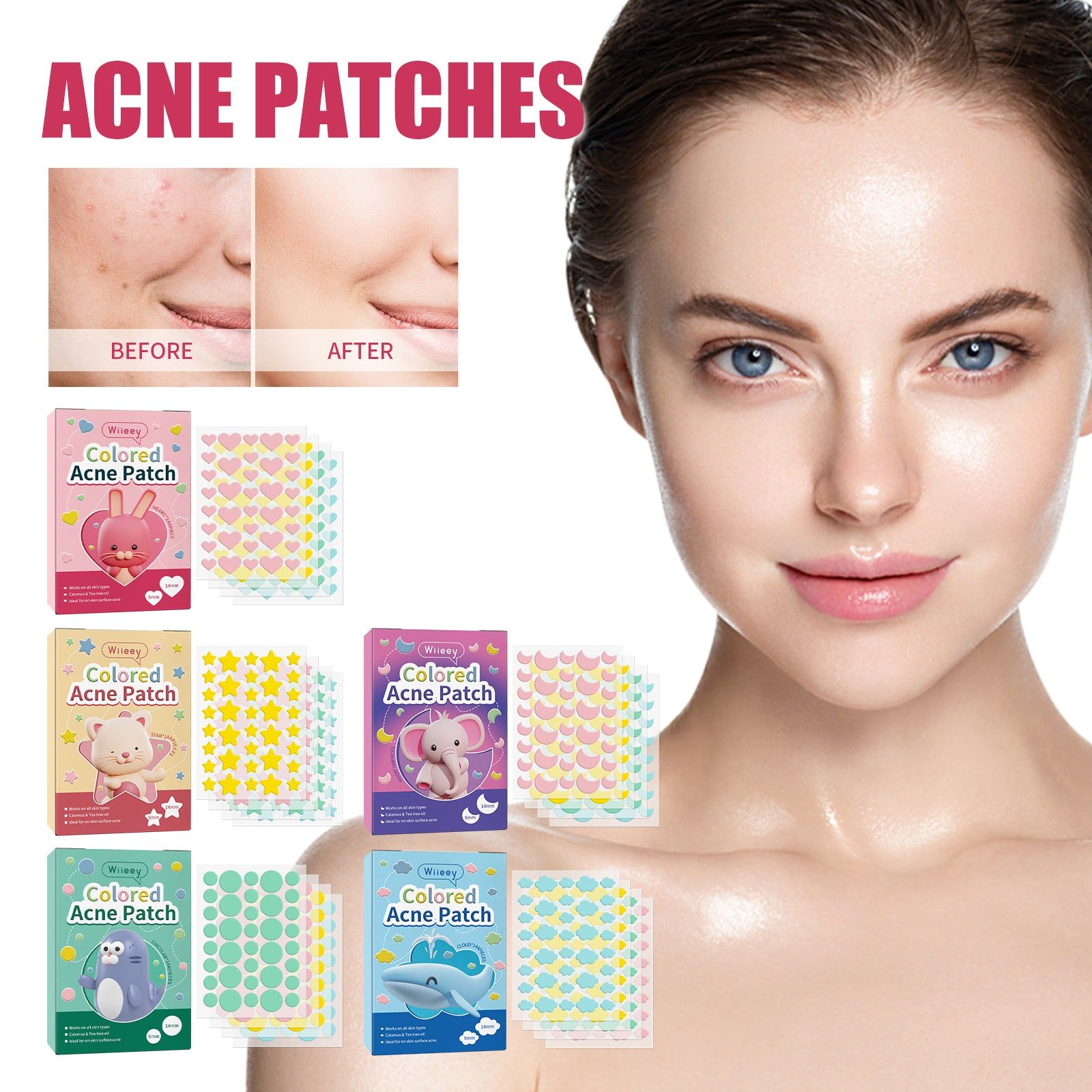 Clear Acne Marks Fast, Hydrating, Pimple Patches for Spot Healing, Acne Scar Treatment ,144pcs