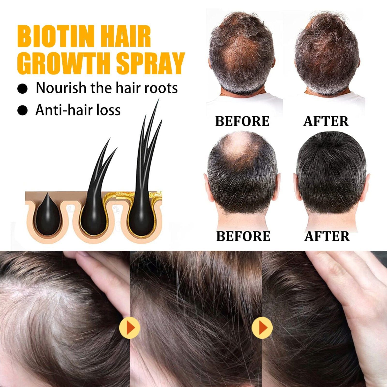 Biotin Hair Growth Spray, Thicker Healthier Hair, Anti-Rip Repair, Scalp Nourishment ,30ml