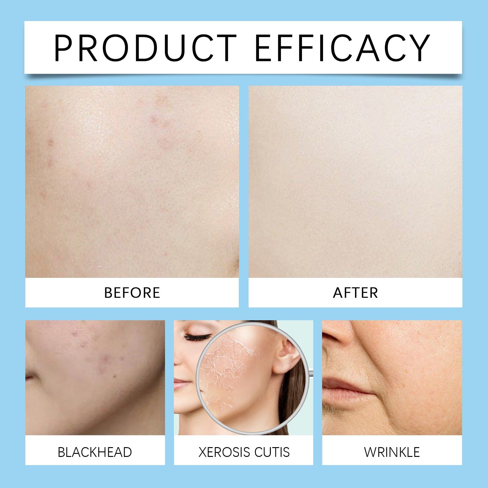 2% Salicylic Acid Serum for Moisturizing, Acne Repair, Clear Skin, Glow ,60ml