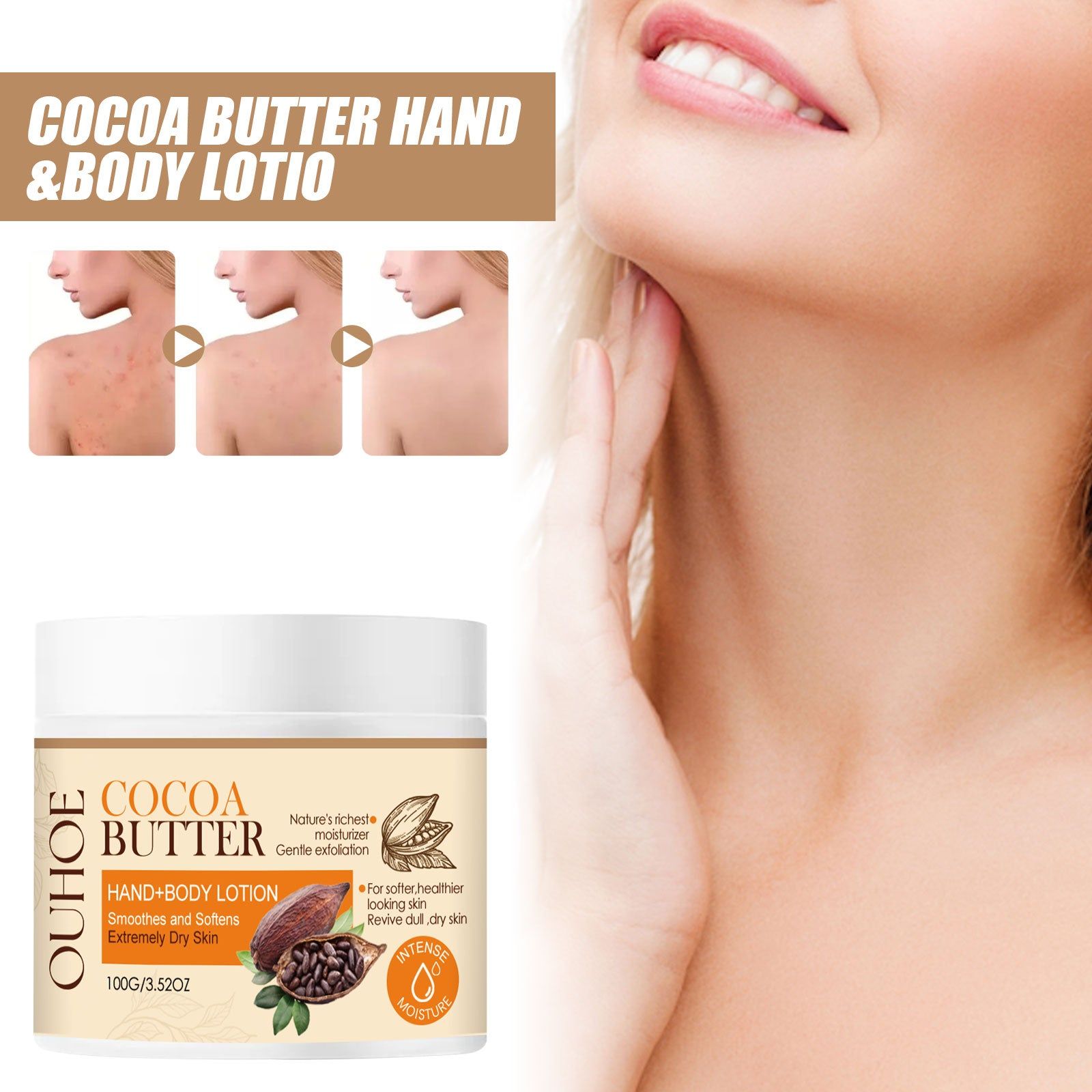 Cacao Body Lotion Brightening and Hydrating Skin, Acne Mark Removal, Natural Moisturizer ,100g