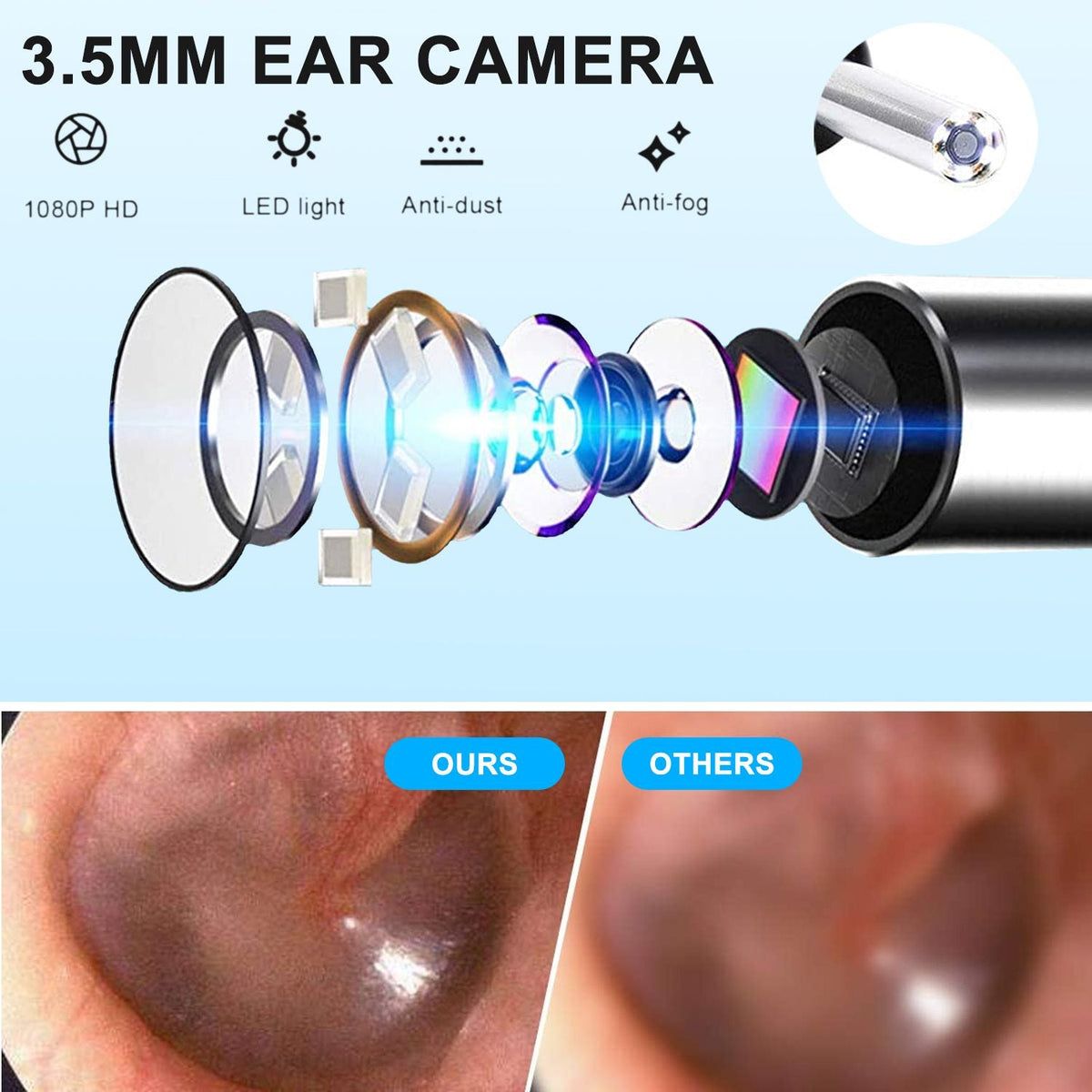 Ear Wax Cleaner Ear Picker Smart Ear Stick Wireless Ear Wax Removal Tool With Otoscope