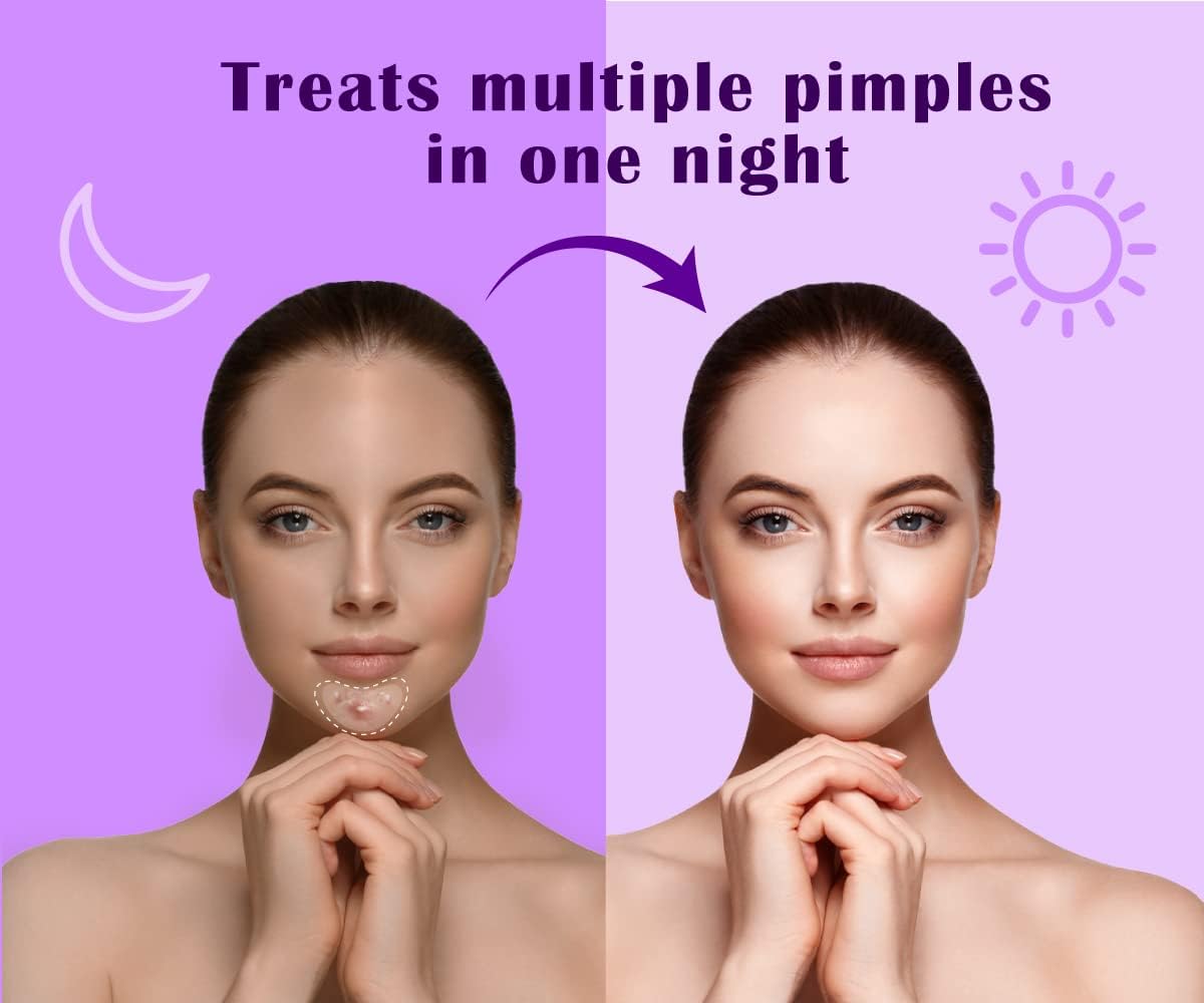 Urban Yog Acne Curvy Pimple Patch - Invisible Facial Stickers cover with 100% Hydrocolloid, Pimple/Acne Absorbing patch