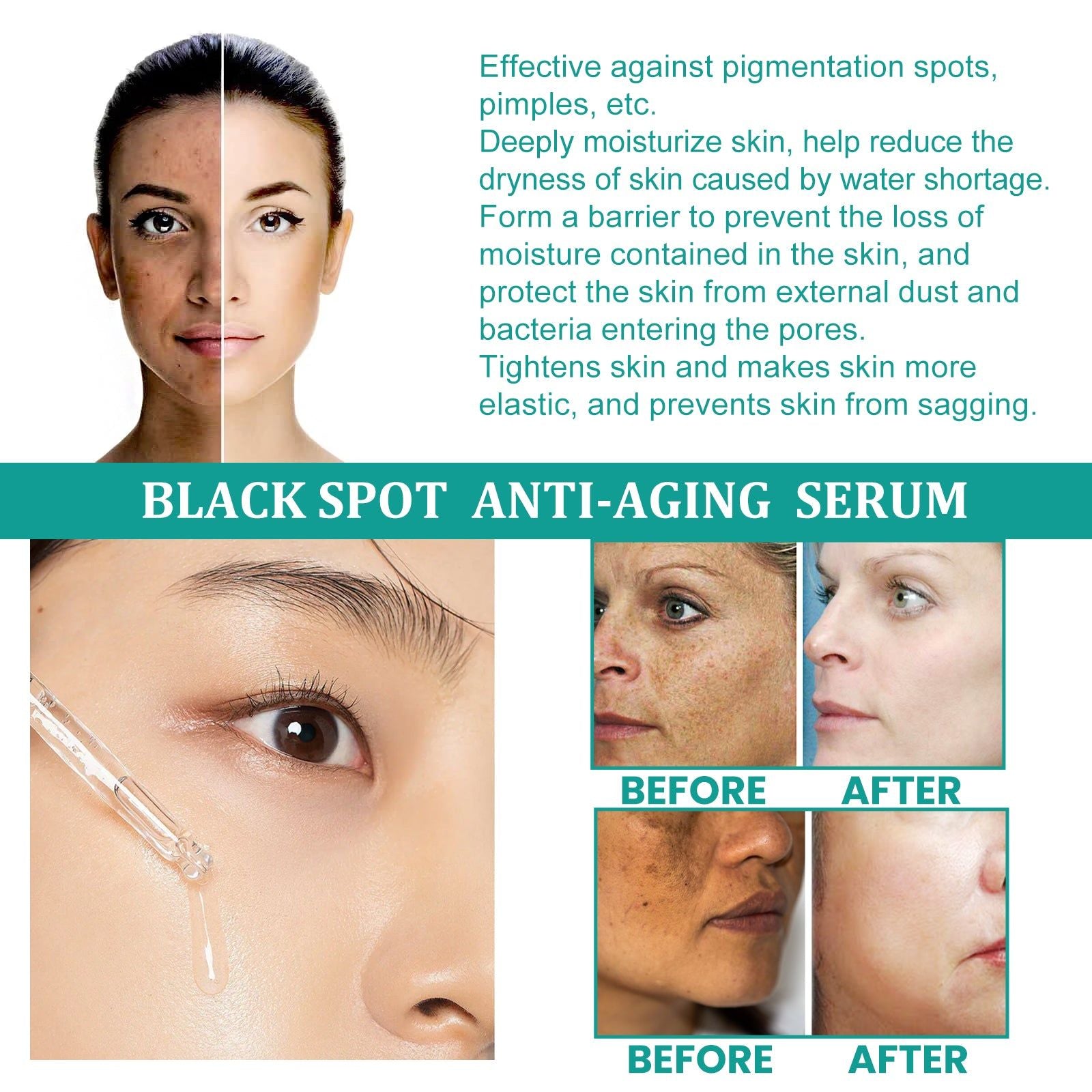 Dark Spots & Fine Lines Serum, Naturally Moisturizes, Fades Pigmentation, Anti-Aging ,30ml