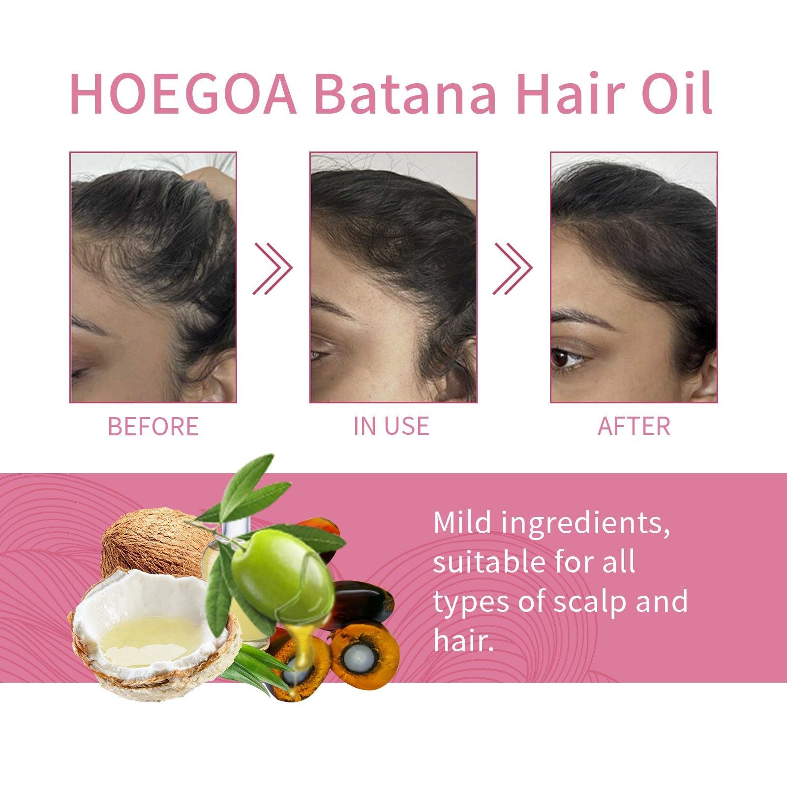 Batana Hair Oil for Thick, Glossy, Strong Hair, Scalp Nourishing, Hair Growth ,60ml
