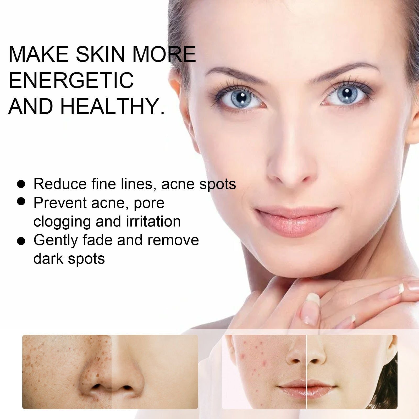Clear Acne Spots Fast, Brighten Skin, Moisturize, Reduce Acne and Pores ,20g