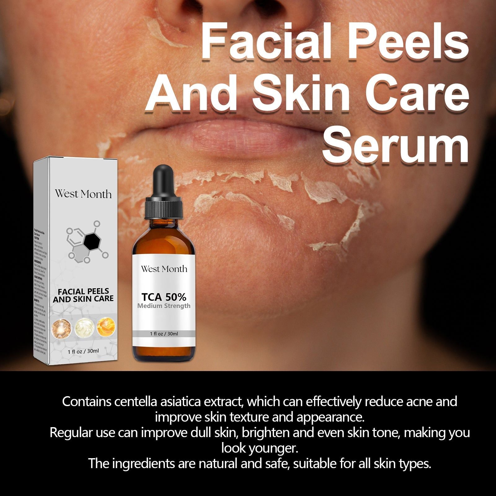 Brighten Skin Serum for Acne Marks, Clear Pores, Natural Face Treatment ,30ml