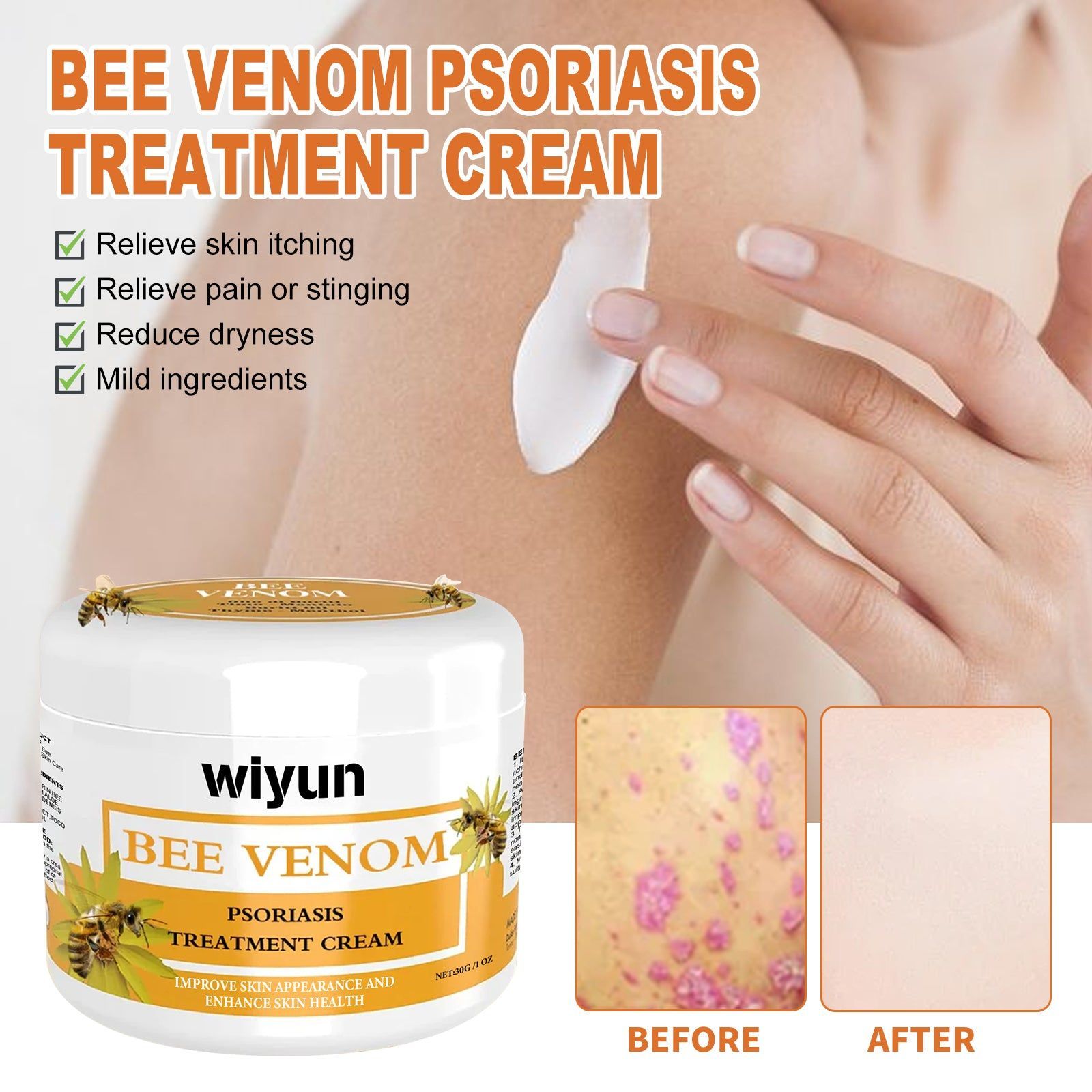 Bee Venom Skin Cream for Repair Smooth Skin, Moisturize, Relieve Itching, Psoriasis Treatment ,30g