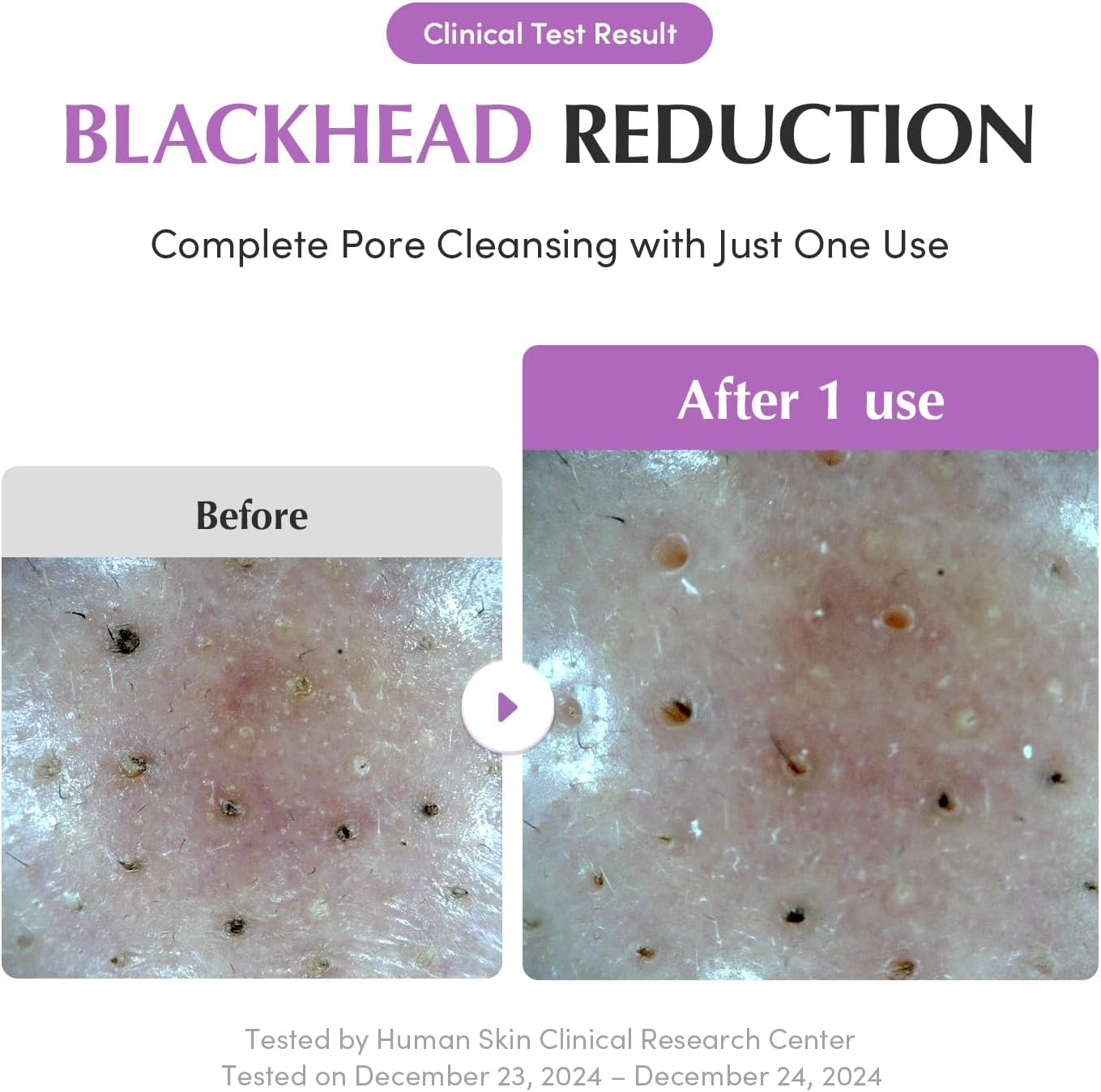 Eqqualberry Purple Rice Double Cleanse Combo