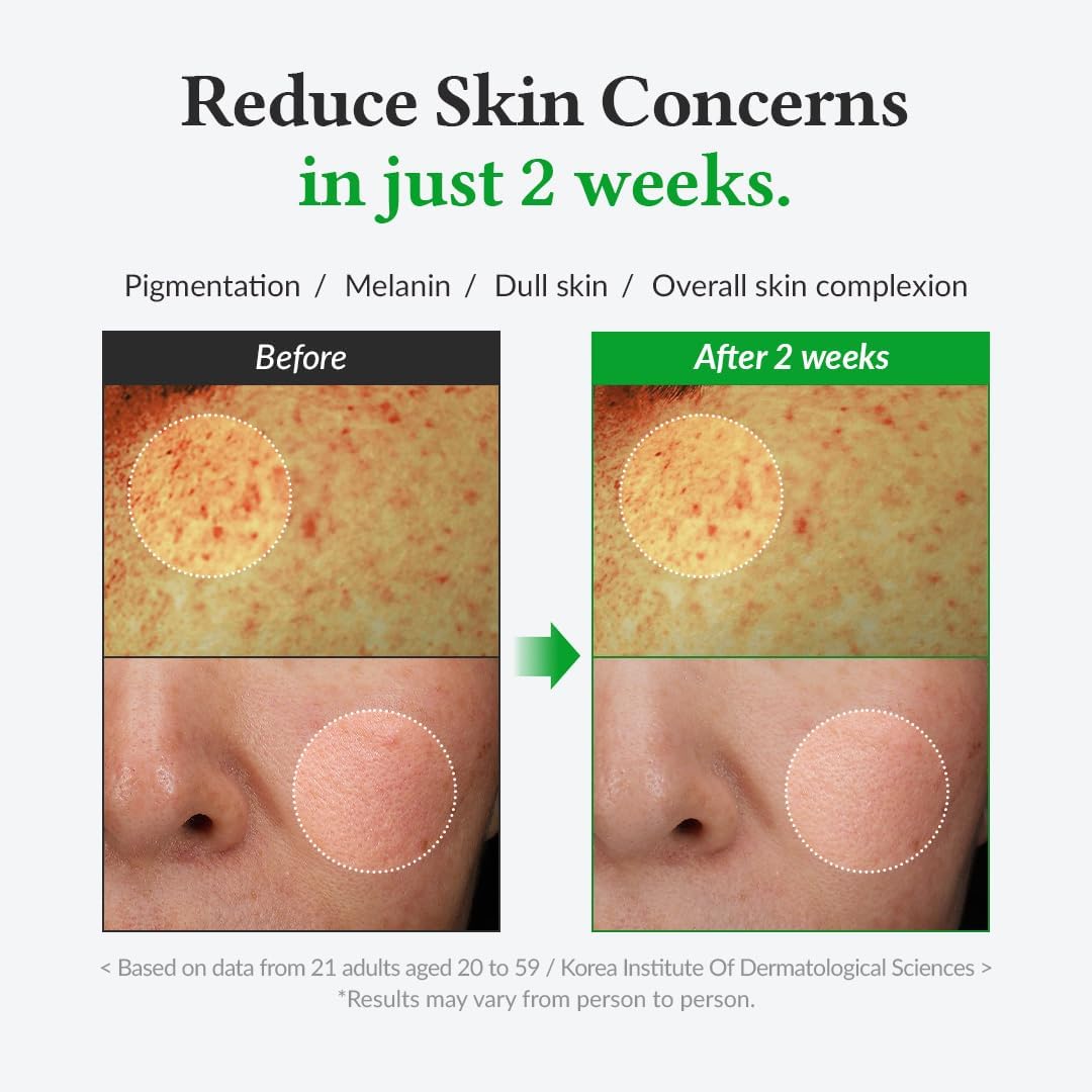 Dr.Althea Gentle Vitamin C Serum