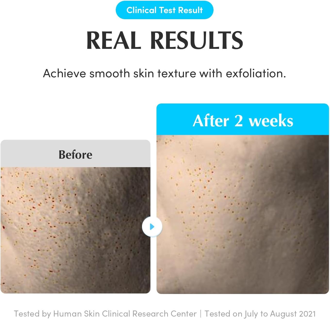 Eqqualberry Swimming Pool Toner 155Ml