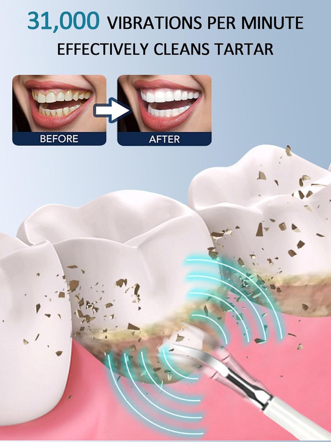 Electric Teeth Cleaner Teeth Cleaning Dental Cleaner Tar Remover