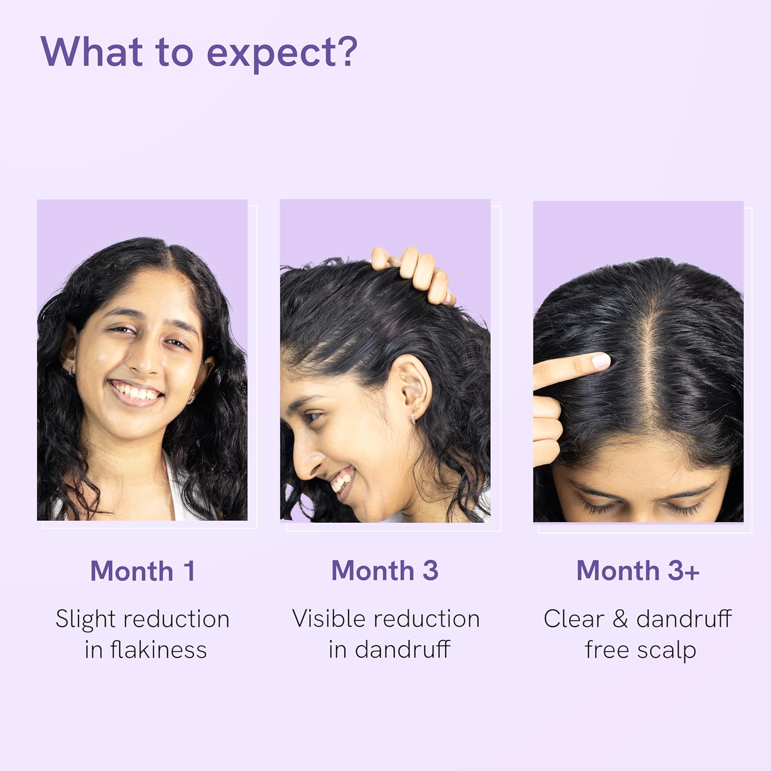 Be bodywise Anti Dandruff Scalp Serum 50ml