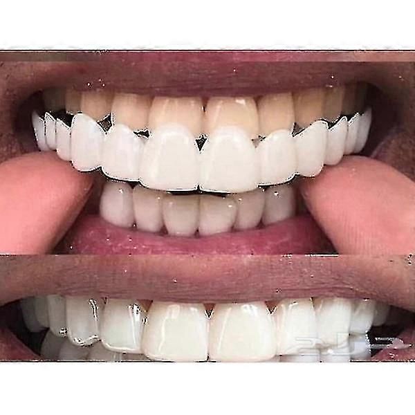 Upper/lower Comfort Fit Flex Whitening Denture Braces-bbcs zxin