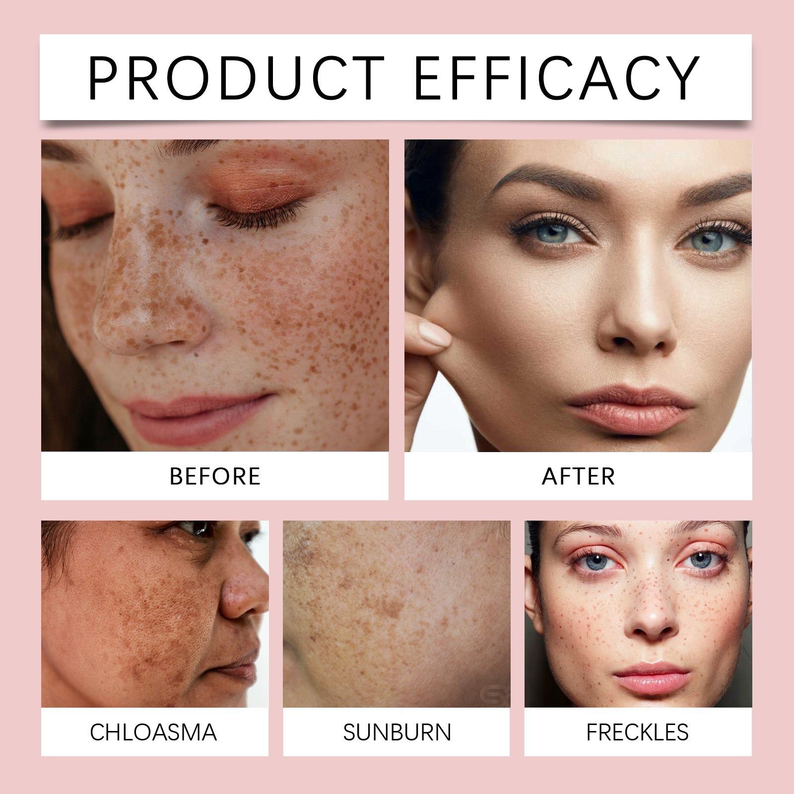 Revitalize Aging Skin with Freckle Brightening Serum, Youthful Glow, Skin Firming ,15ml