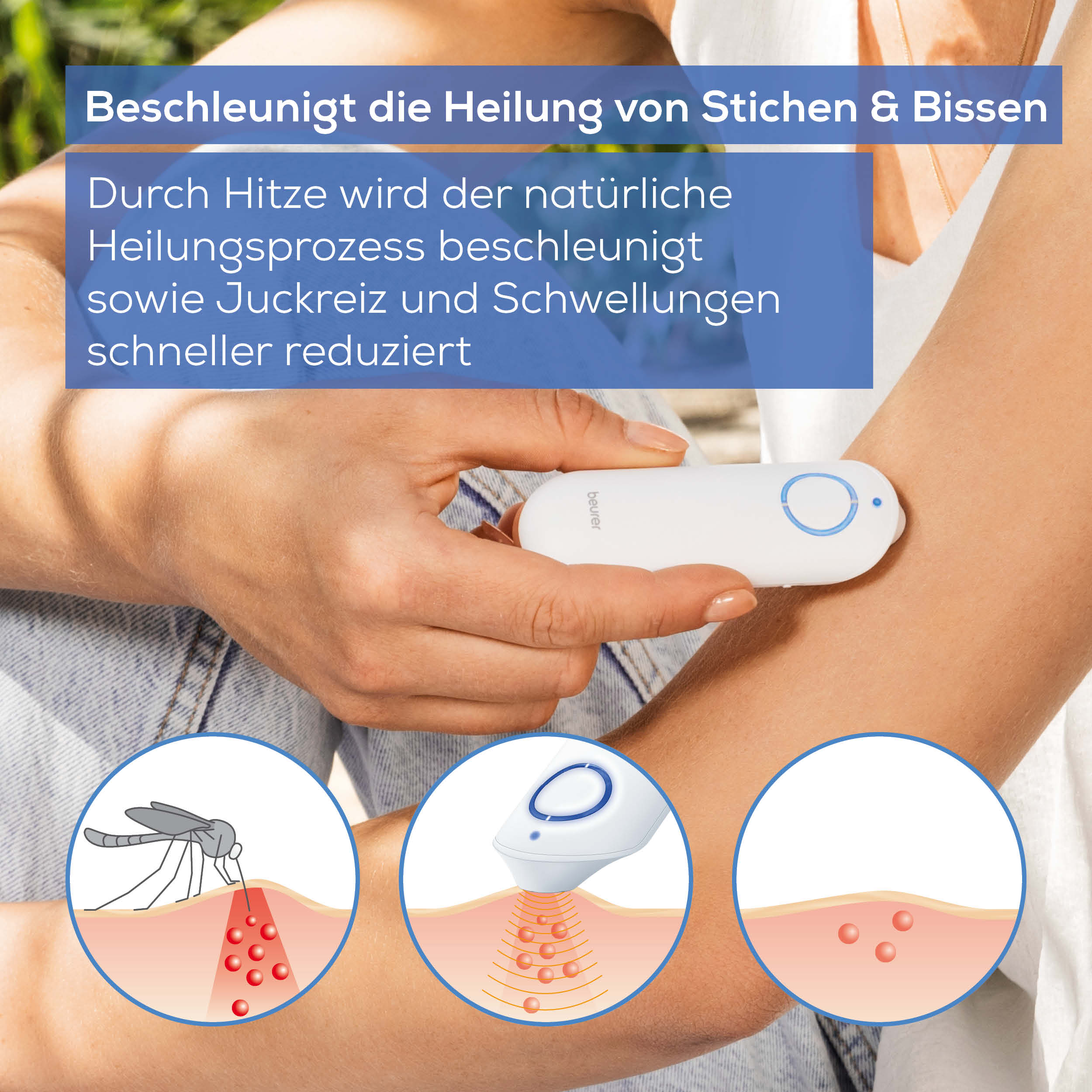 Beurer Insect bite healer BR 60