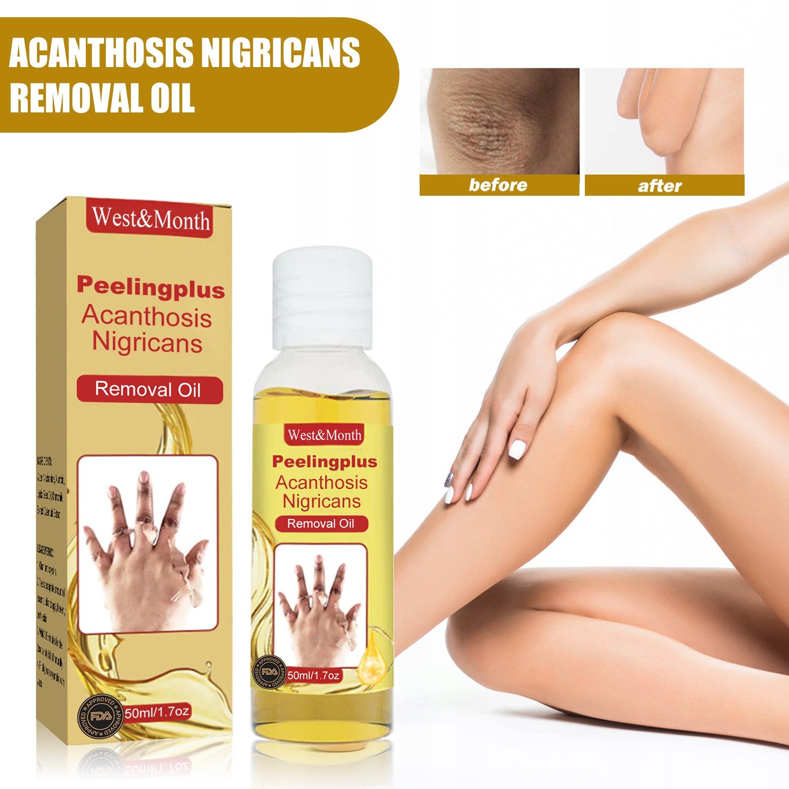 Acanthosis Nigricans Removal Oil, Brightening Skin, Dark Spot Corrector, Natural Exfoliating, Skin Lightening, Melanin Reducer ,50ml