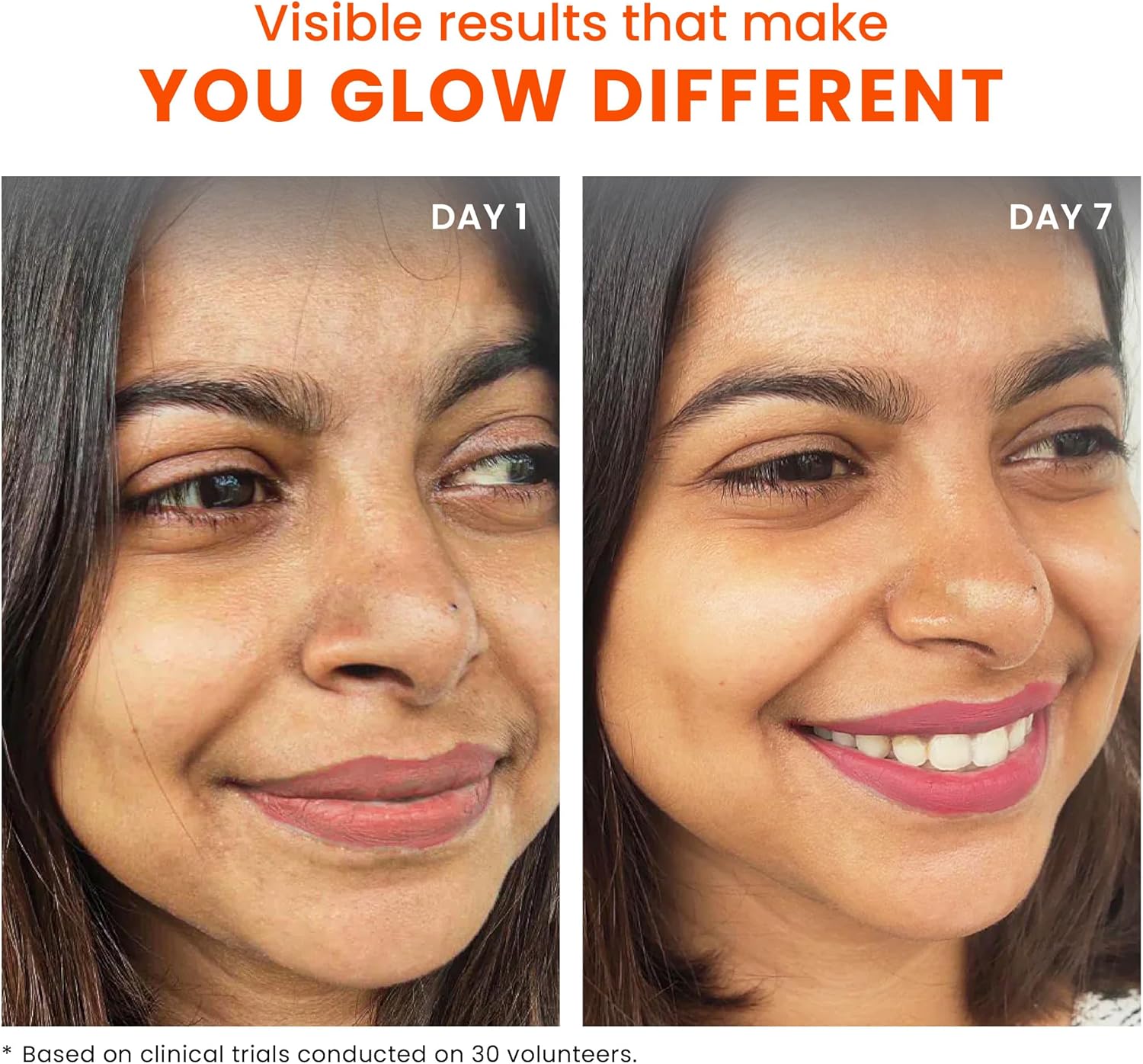 Foxtale The Diva Over Night Glow Mask (30Ml)