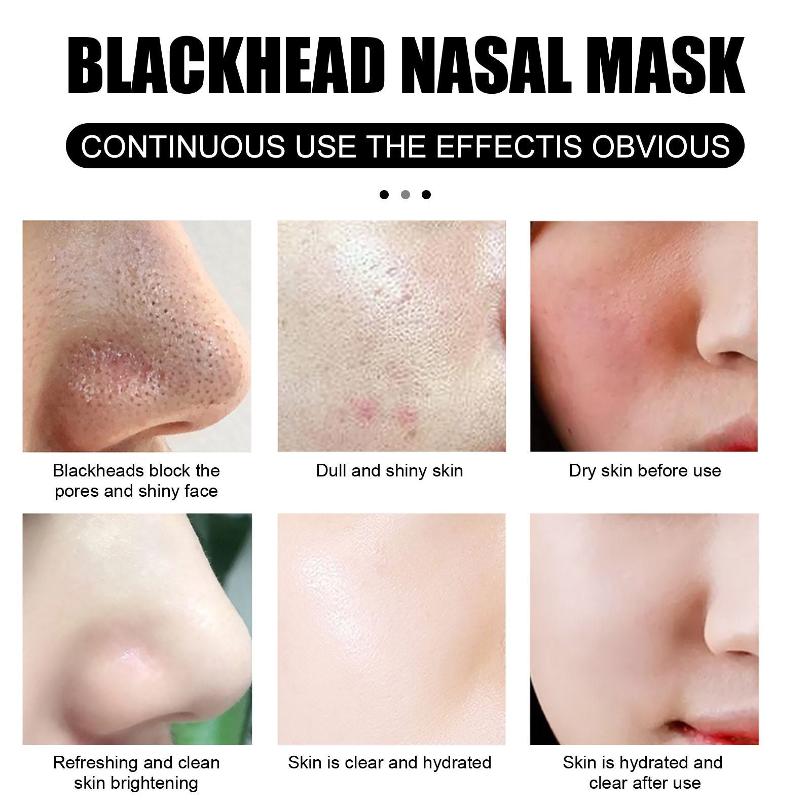 Blackhead Peel Off Nose Mask Kit with 60 Strips