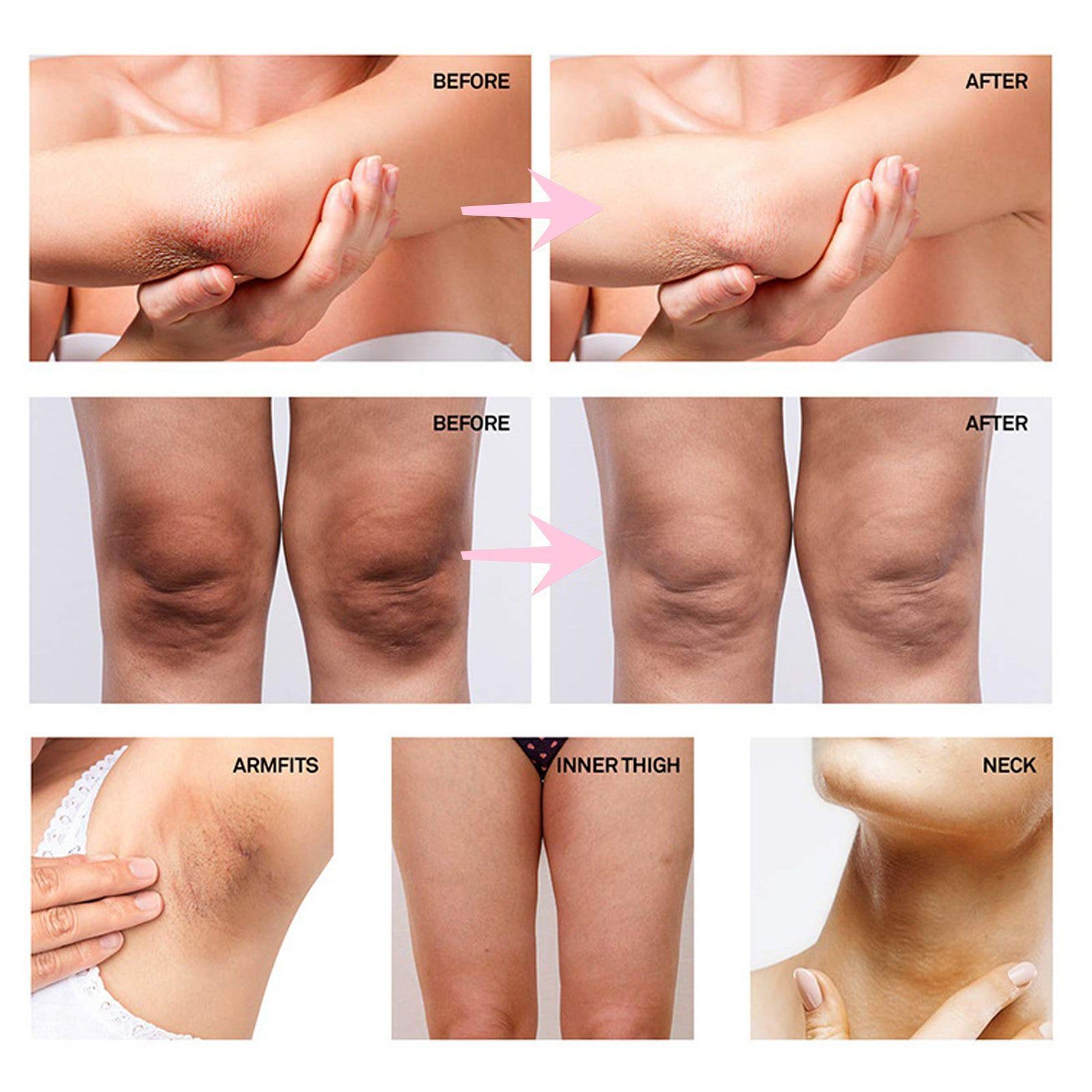 Brighten White Body and Underarms, Intimate Corrective Cream for Dark Skin, Moisturizing and Repair ,30ml