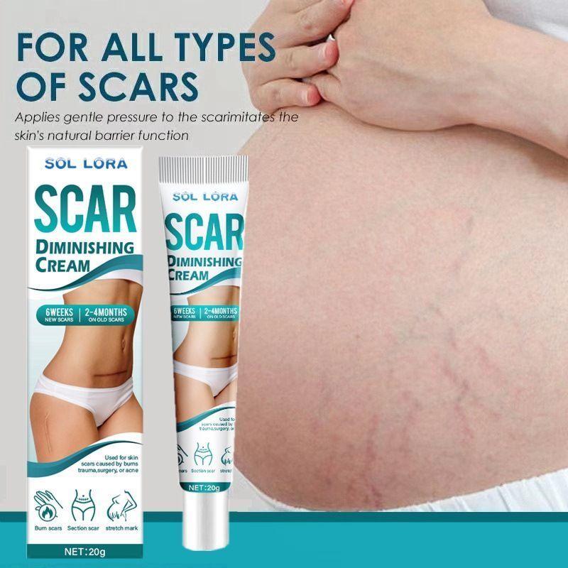 SOL LORA Scar Diminishing Cream - Herbal Formula for Surgical Scars, C-Section Scars, Acne Marks & Postpartum Stretch Marks