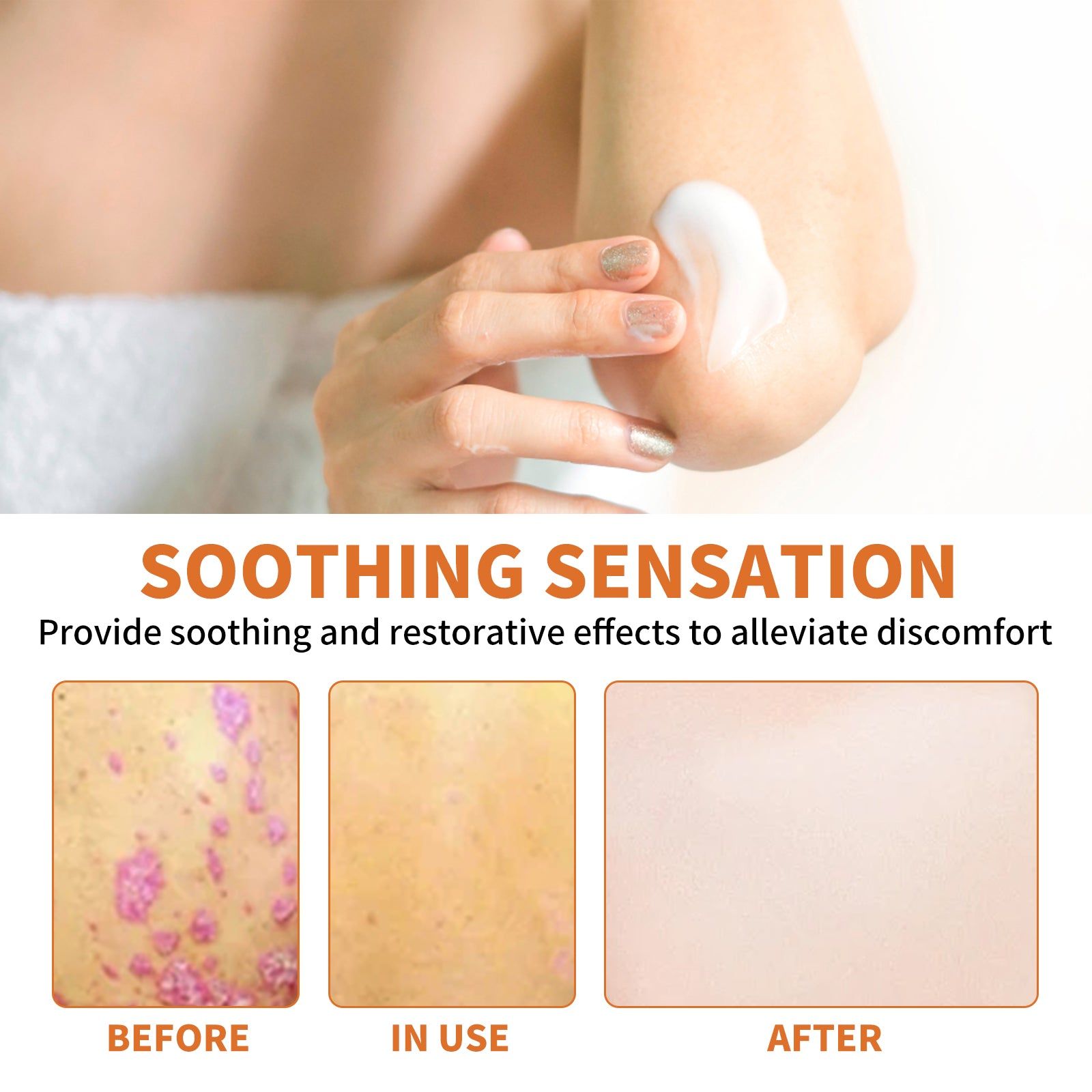 Bee Venom Skin Cream for Repair Smooth Skin, Moisturize, Relieve Itching, Psoriasis Treatment ,30g