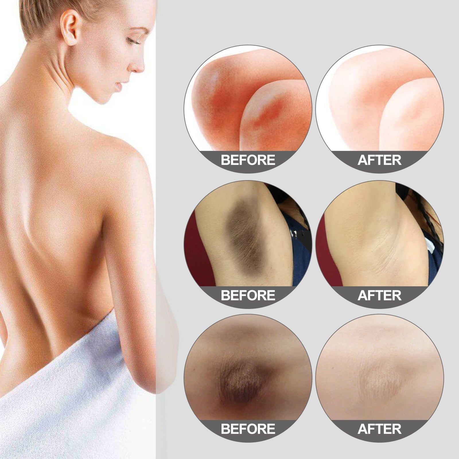 Body Care Brightening Cream for Thighs, Armpits, Knees, Moisturizing, Radiance ,30g