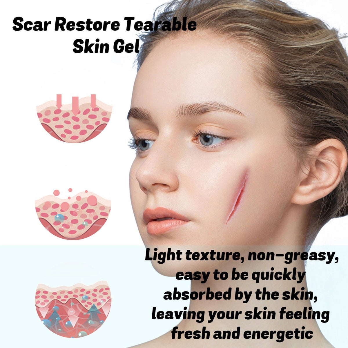 Moisturize Scars Fast, Repair Skin, Fade Scar Gel, Gentle, Non-Greasy, Smooth Skin ,20g