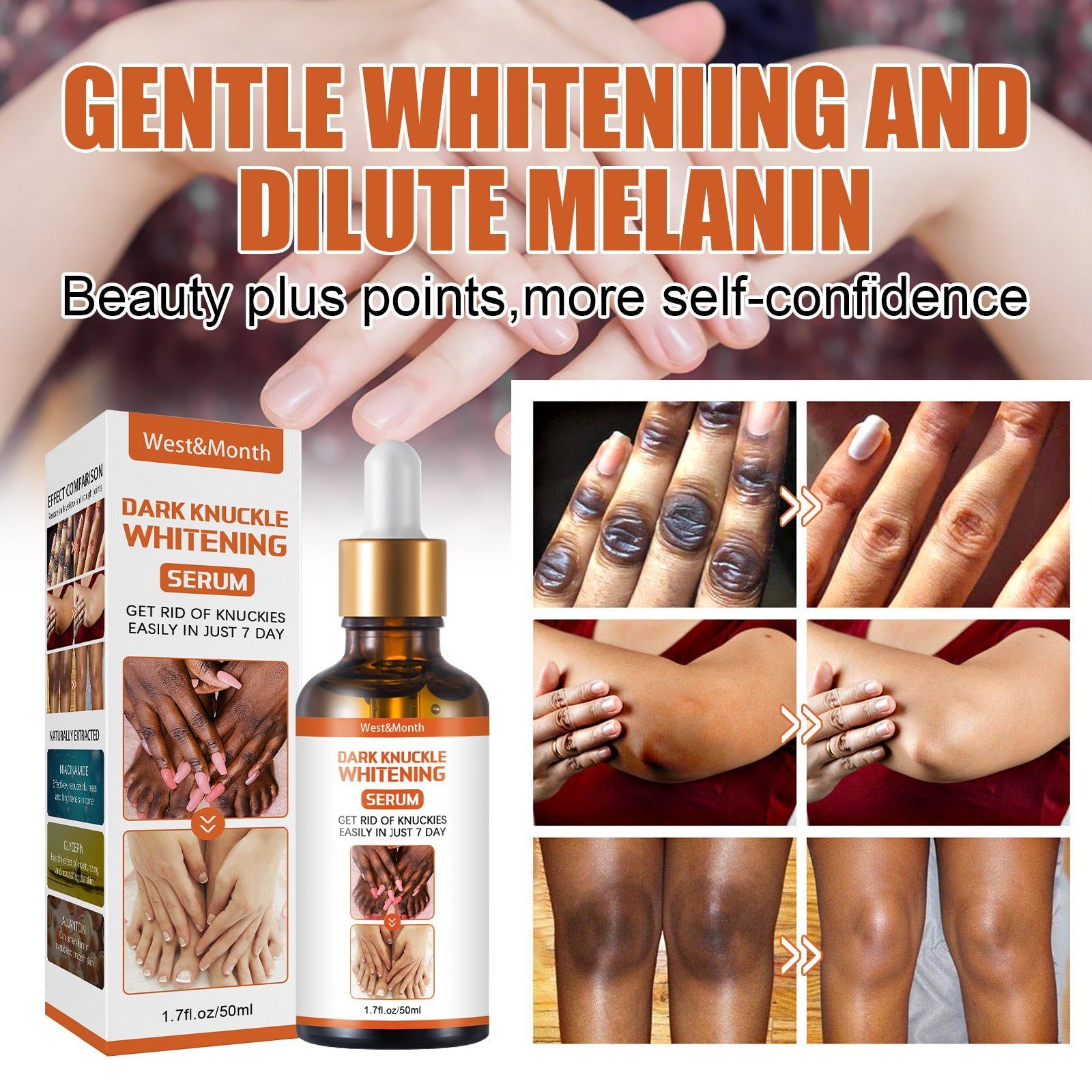 Blackening Essence for Joints, Body, Brightening, Melanin Removal, Moisturizer ,50g