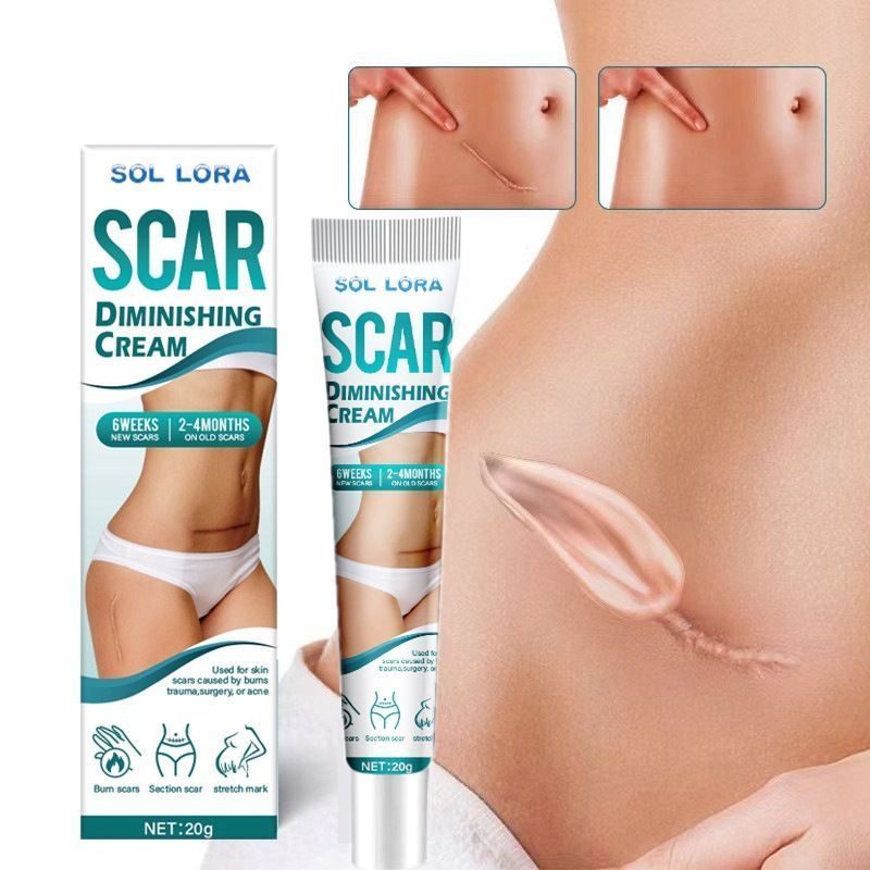 SOL LORA Scar Diminishing Cream - Herbal Formula for Surgical Scars, C-Section Scars, Acne Marks & Postpartum Stretch Marks