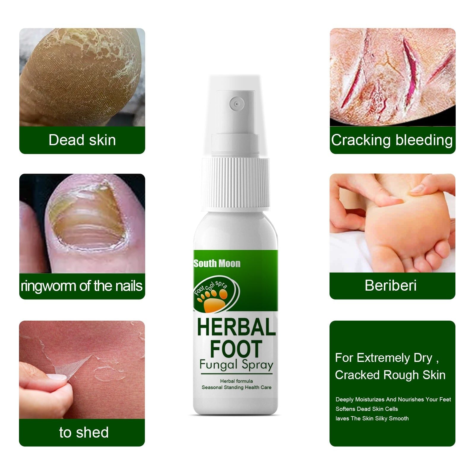 Revitalize Damaged Toenails, Fungal Foot Spray, Odor & Itch Relief, Fast Healing ,30ml