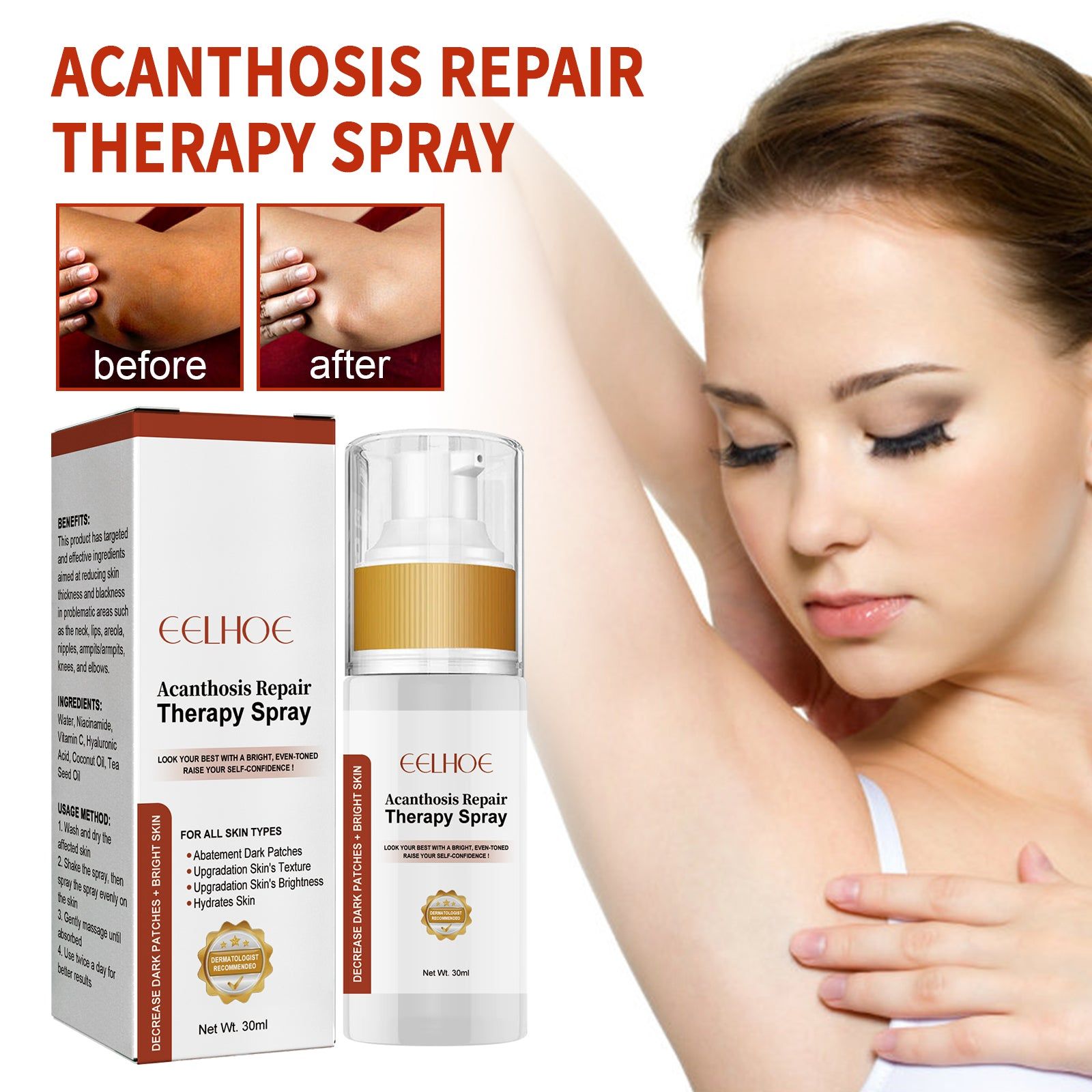 Black Acanthoderma Treatment Spray for Even Skin Tone, Skin Care, Melanin Repair ,30ml