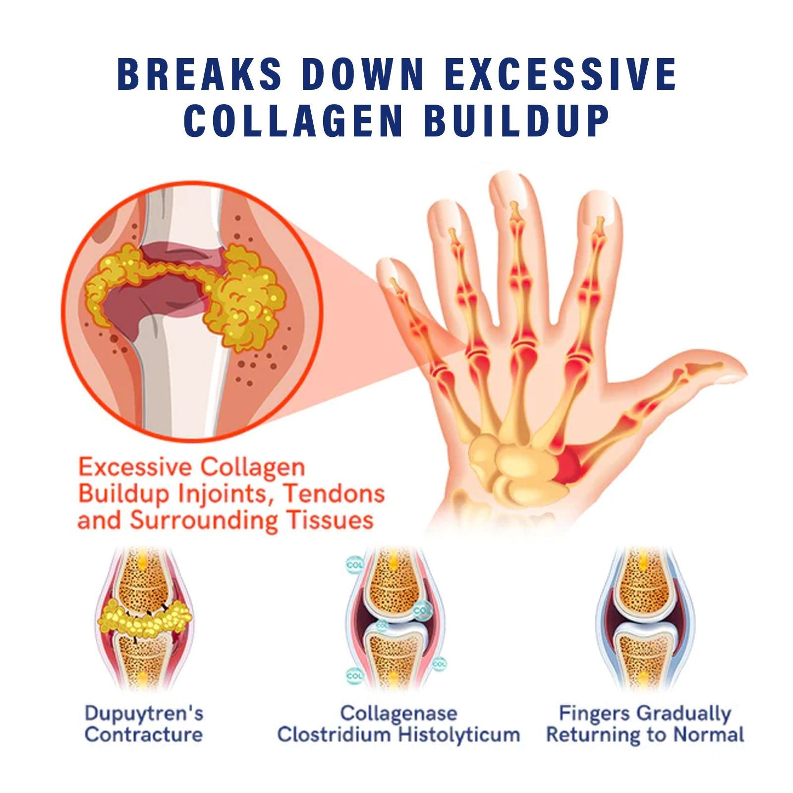 Joint Care Cream Relieves Muscle Pain, Inflammation, Boost Flexibility ,50g