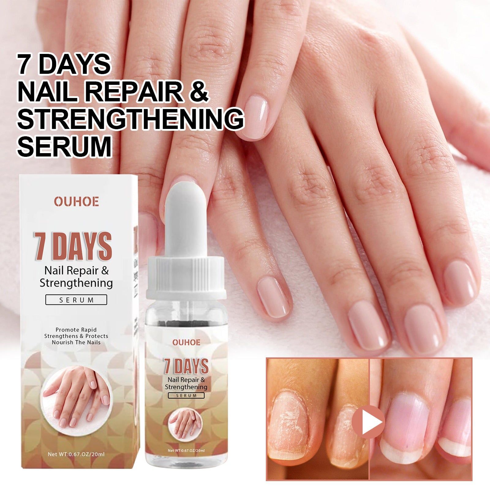 7 Day Gray Nail Repair Serum, Nail Growth & Strengthening Solution, Fast Recovery ,20ml
