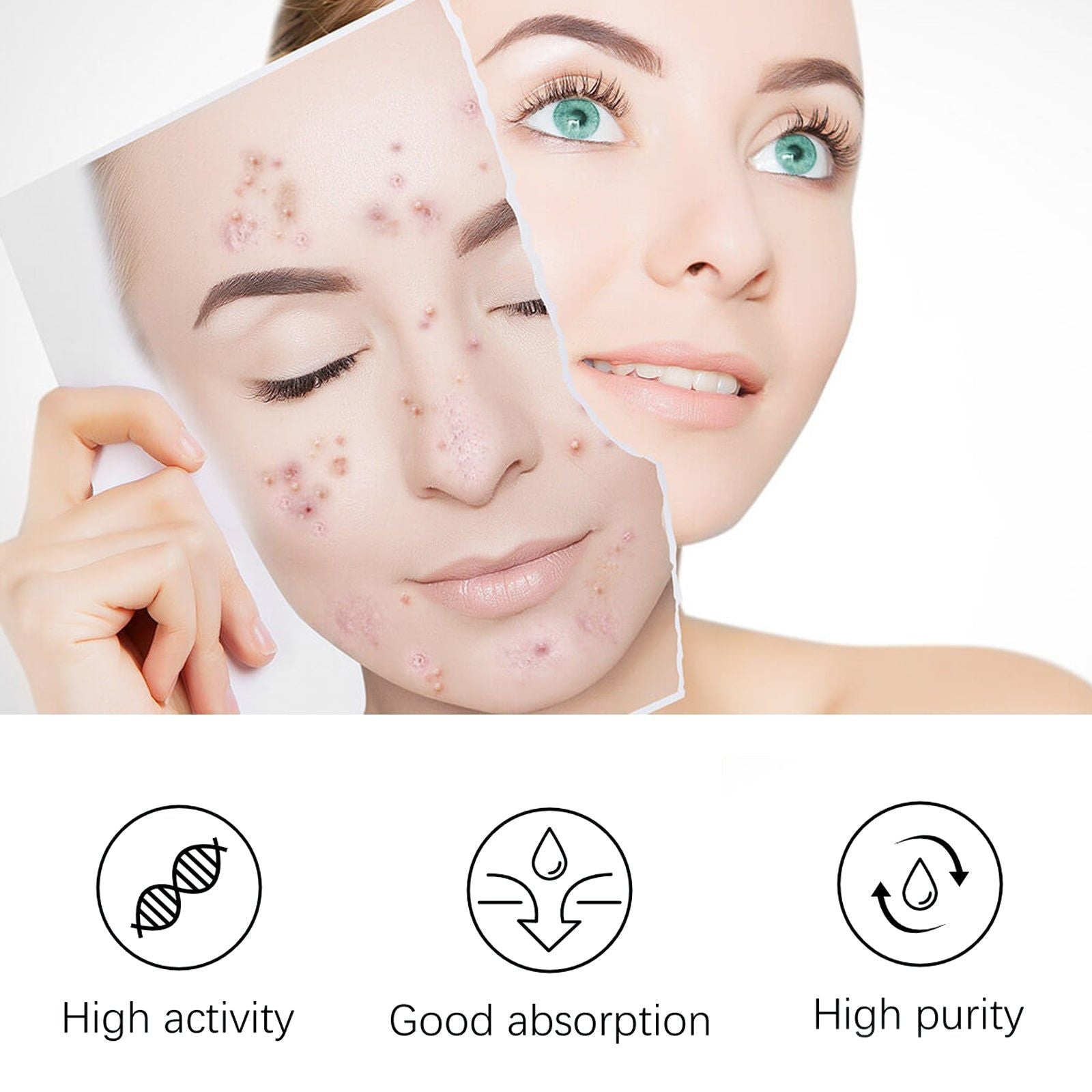 Blemish Smoothing Emulsion, Acne Spot Removal, Clear Skin, Pimple Treatment ,30g