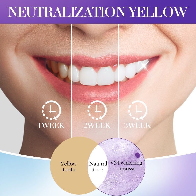 Whitening Foam Toothpaste for Yellow Teeth Removal - 001-SD11160