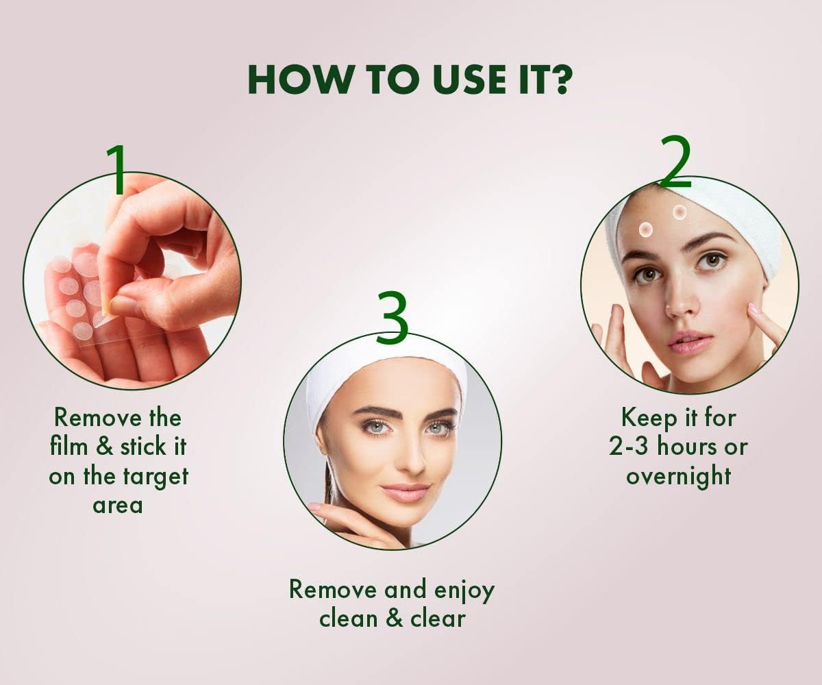 Urban Yog Acne Pimple Patch - 36 Invisible Facial Stickers