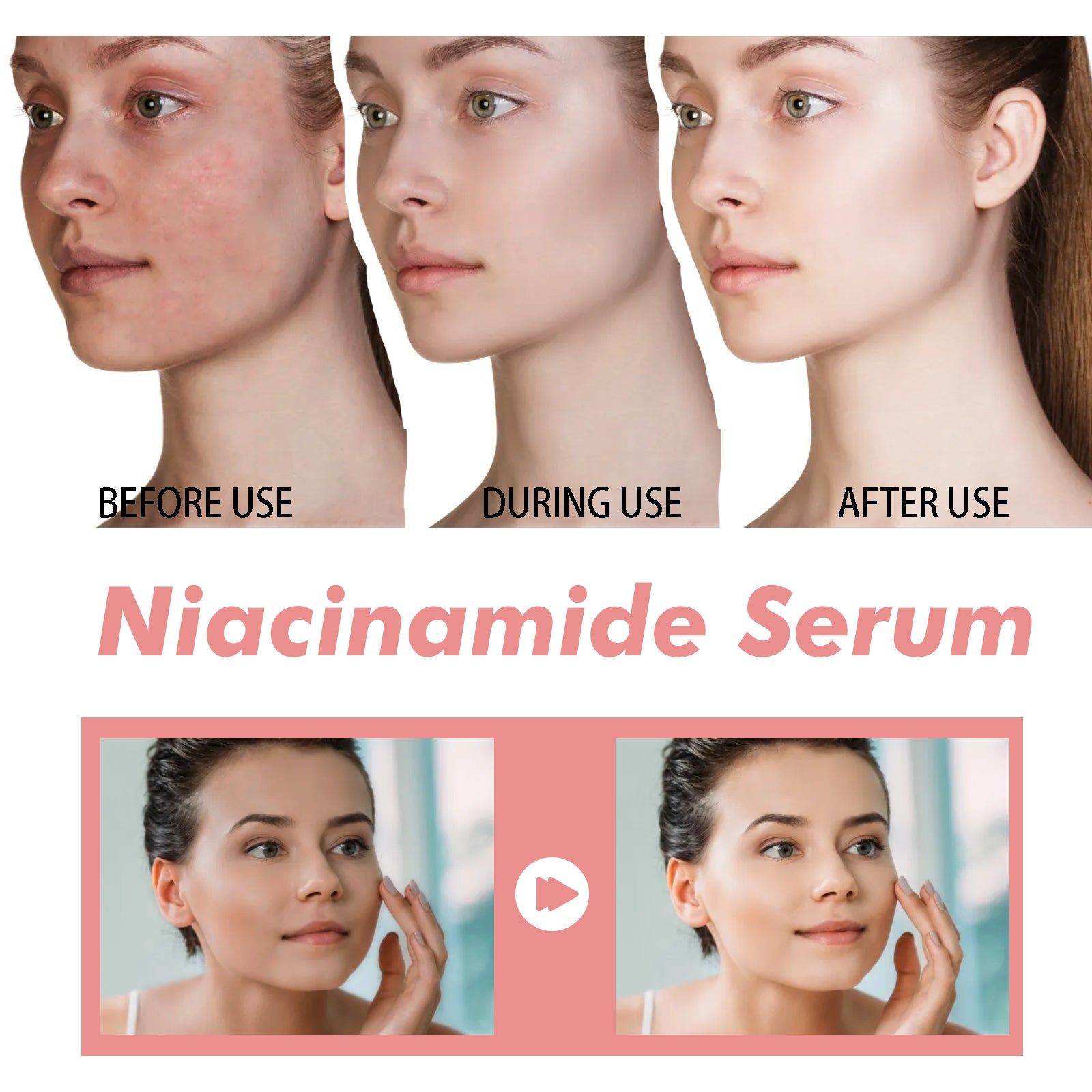 Nicotinamide Serum for Brightening and Rejuvenating Skin, Reduces Pores, Fades Dark Spots ,30ml