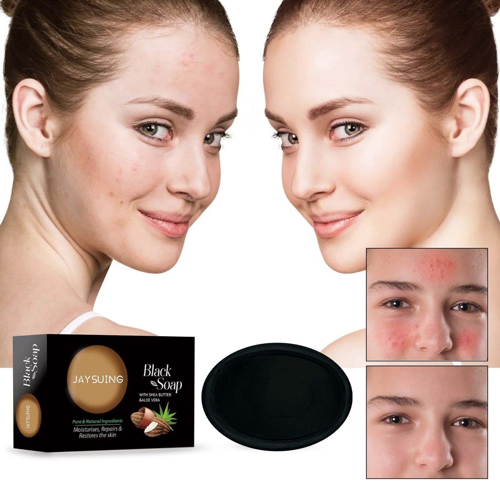 Black Soap for Acne, Pores, Moisturizing, Clear Skin, Body Black Soap, Natural Skincare ,100g