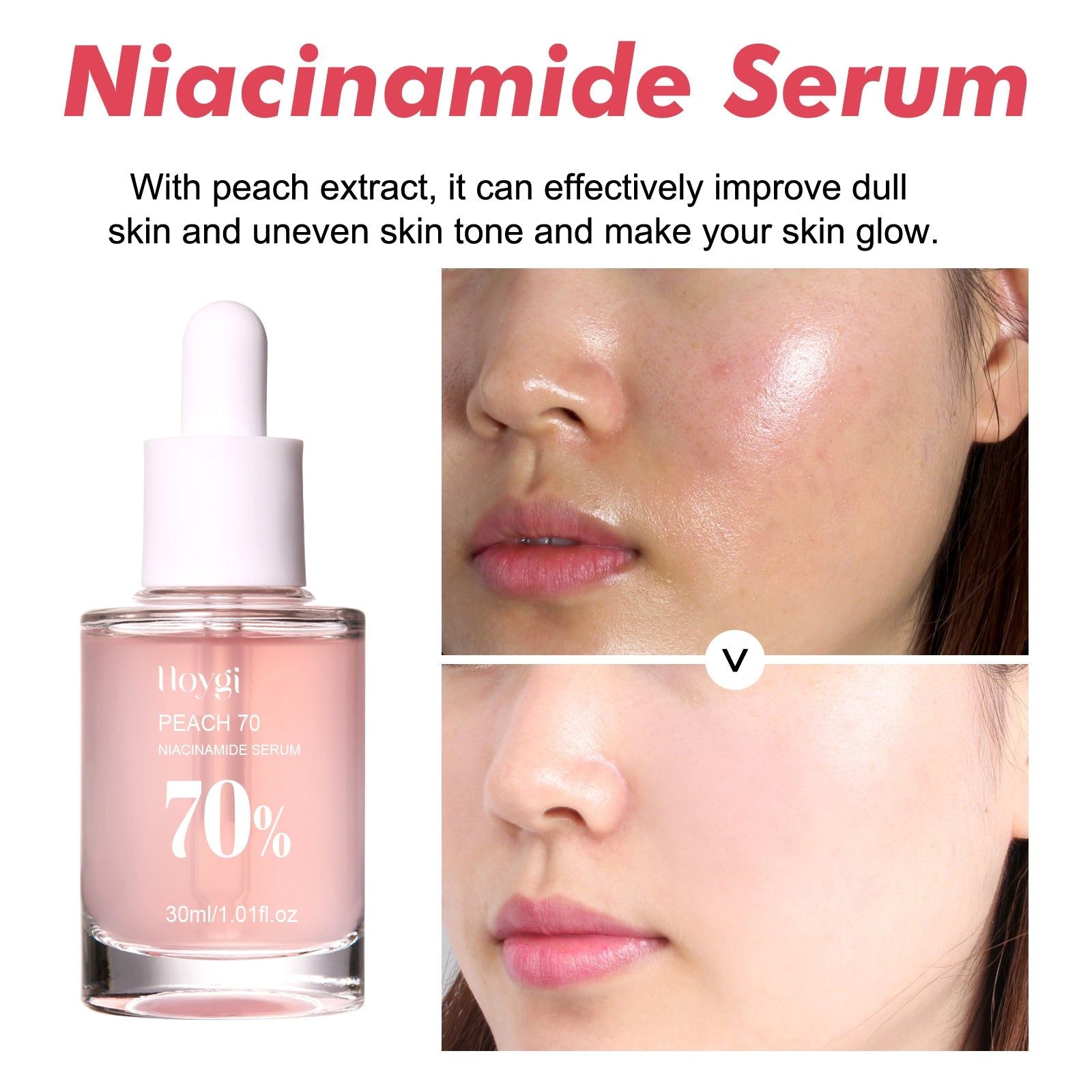Nicotinamide Serum for Brightening and Rejuvenating Skin, Reduces Pores, Fades Dark Spots ,30ml