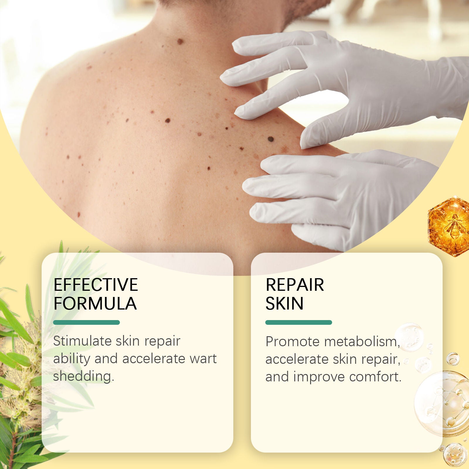 Bee Venom Wart & Mole Removal Spray, Skin Care, Gentle, Moisturizing, Fast Relief ,20ml
