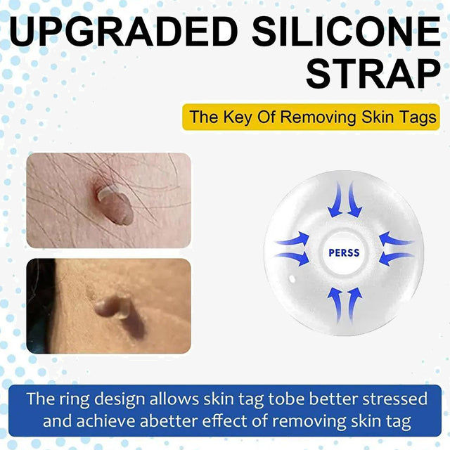 Auto Skin Tags Removal Tool Device with Cleansing Wipes - Safe, Painless Skin Tag Remover Kit