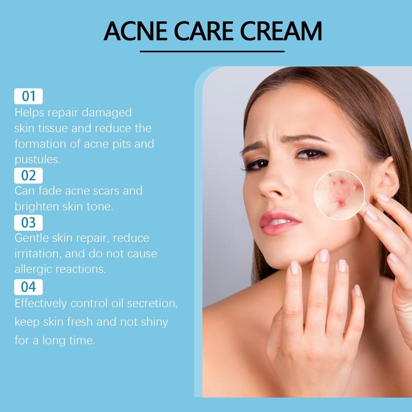 Clear Acne Marks Fast, Acne Repair Cream for Flawless Skin, Pimple Scar Treatment ,20g