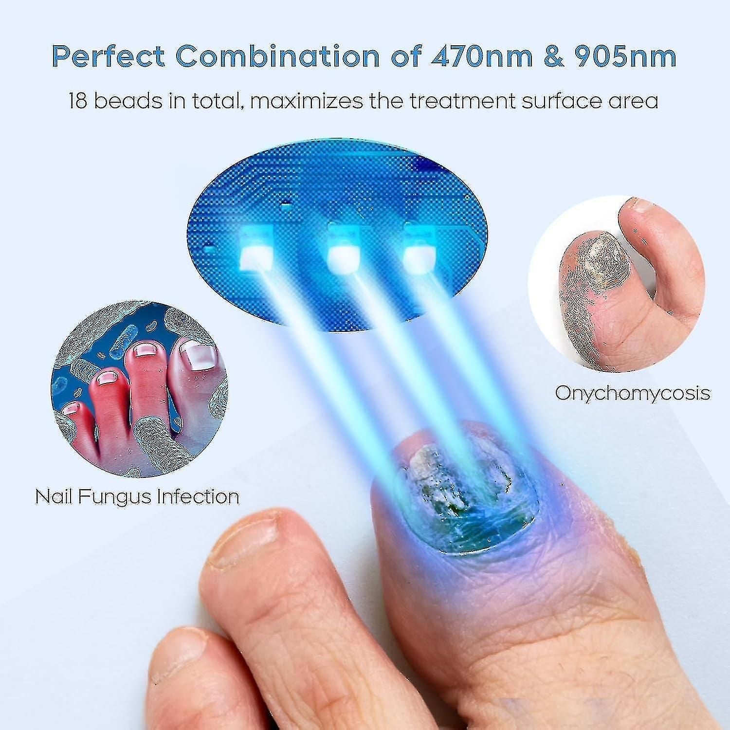 2024 Nail Fungus Laser Treatment Device For Multiple Toenail, Home Use 905nm Infrared Light + 470nm Blue Light Toe Nail Fungus Deviceaa