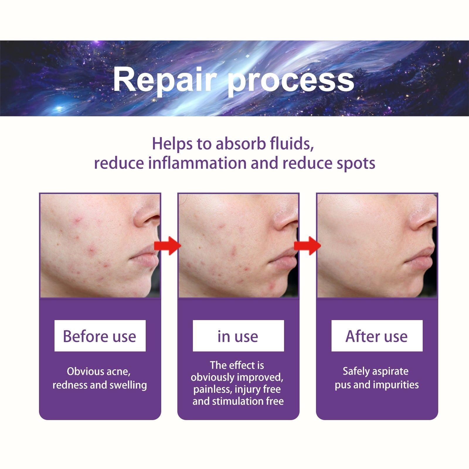 Clear Acne Patches with Salicylic Acid, Waterproof, Fast Healing, Acne Treatment ,180pcs