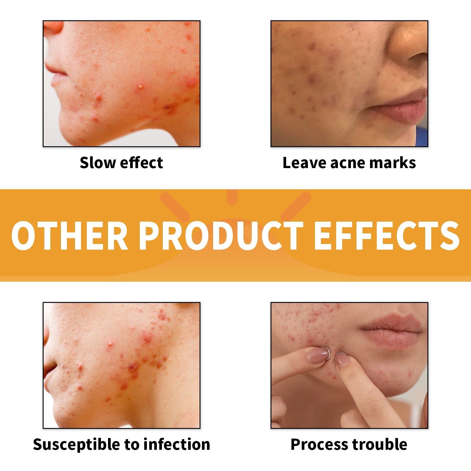 Chin Acne Patch, Smoothing Pimple & Oil Absorbing Hydrocolloidal Mask ,10pcs