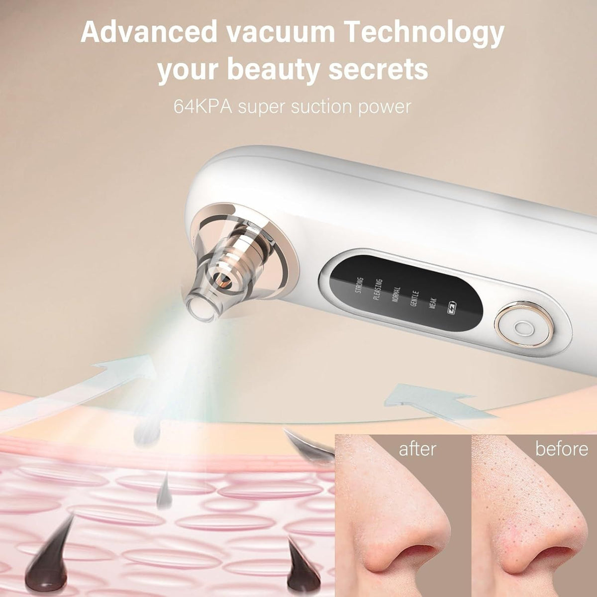 Blackhead Remover Pore Vacuum Kit Face Cleaner Pimple Extractor Tool Kit with 5 Suction Levels