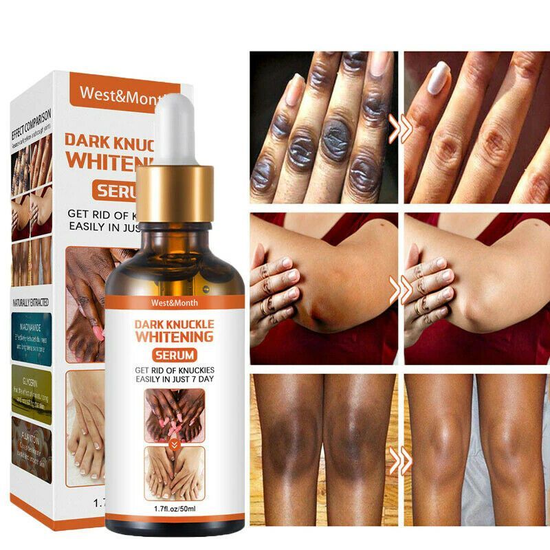 Dark Knuckle Whitening Serum Hand Elbow Knee Brightening Serum Skin Moisturizer