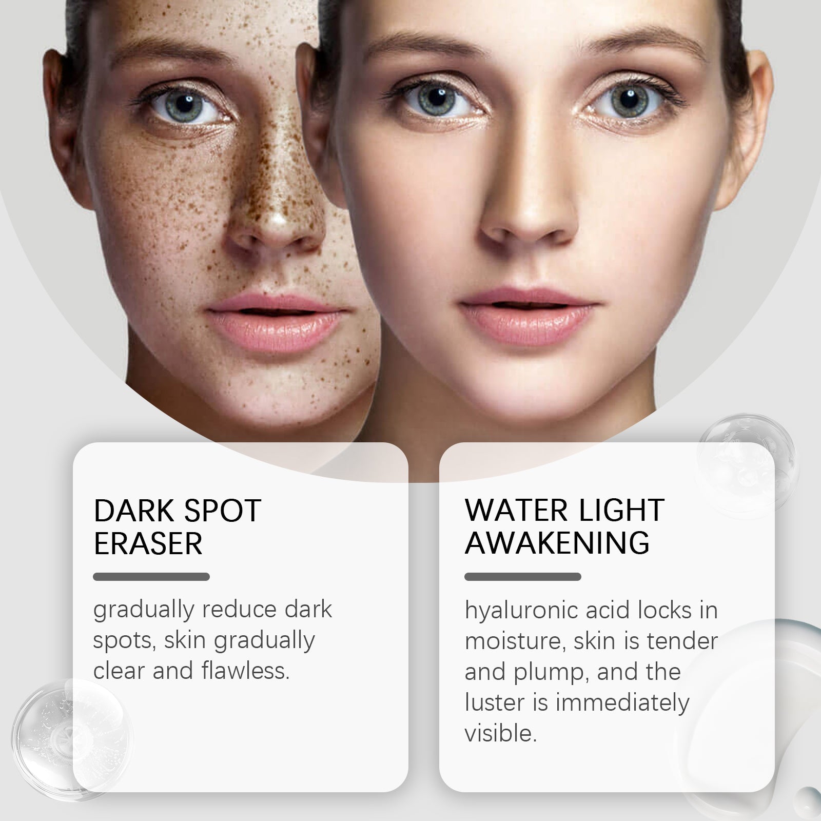 Dark Spot Repair Lotion, Moisturizes and Protects Skin, Brightens and Hydrates ,30ml