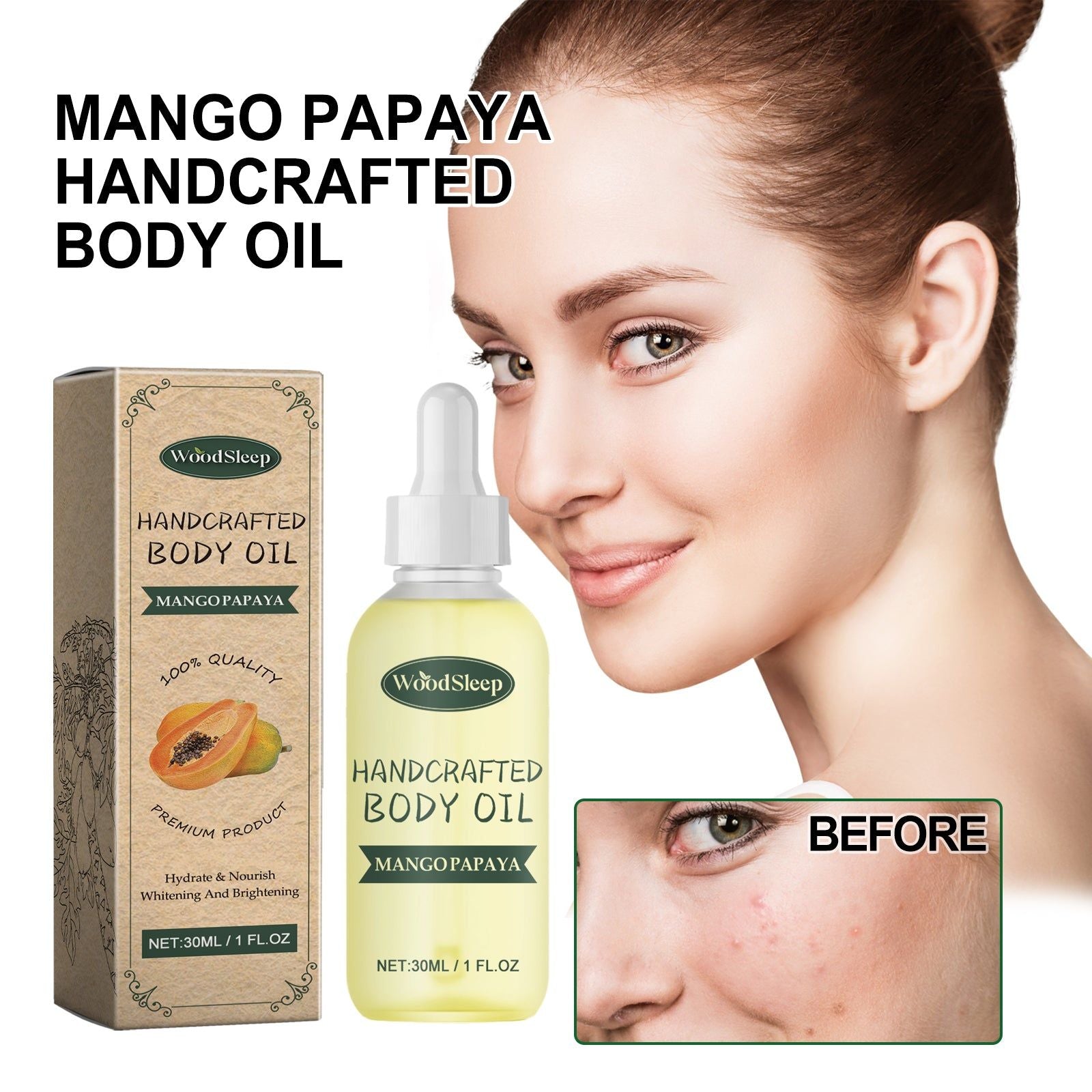Mango Papaya Body Oil for Brightening, Moisturizing, and Acne Mark Removal ,30ml