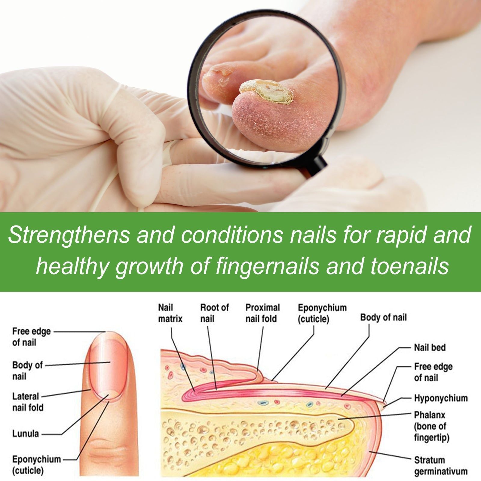 5-Day Nail Repair Roller, Nourishing, Strengthening, Fungal Treatment ,10ml/box